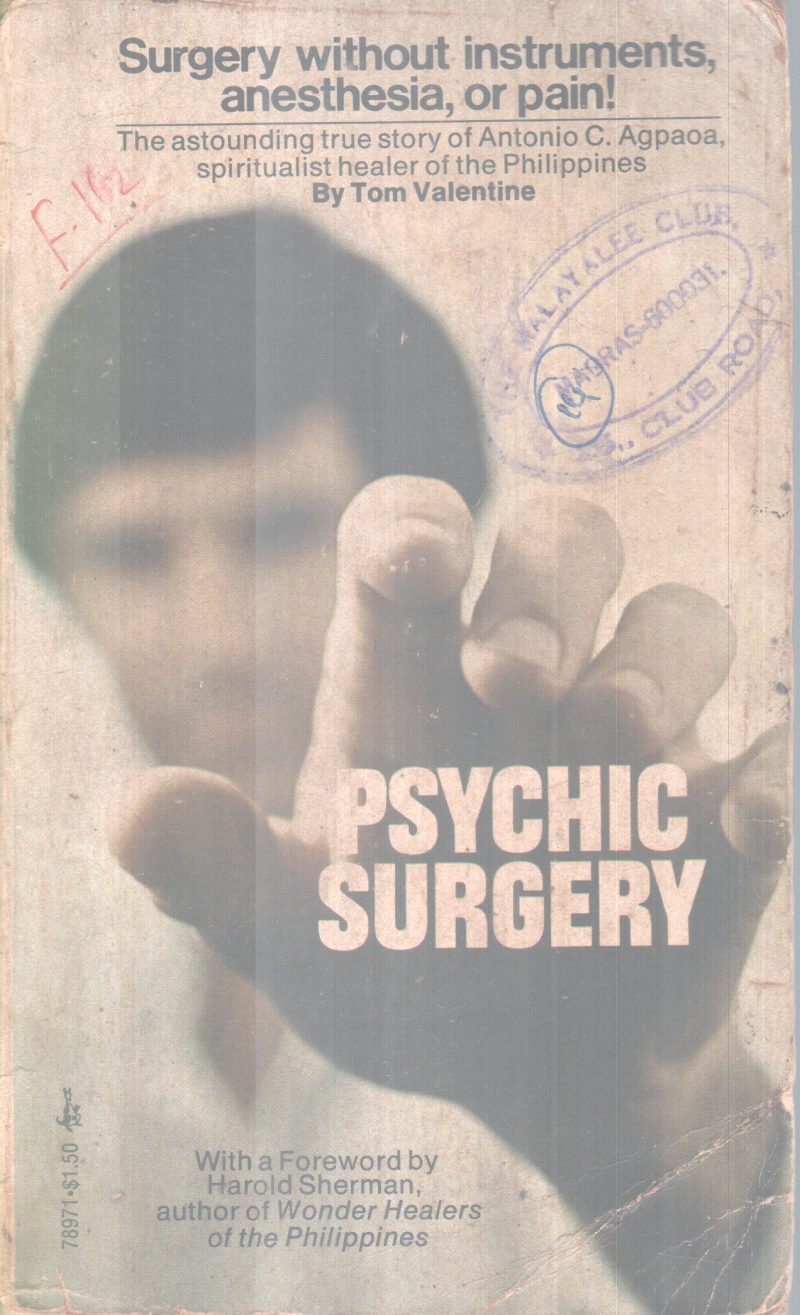 PSYCHIC SURGERY BY TOM VALENTINE